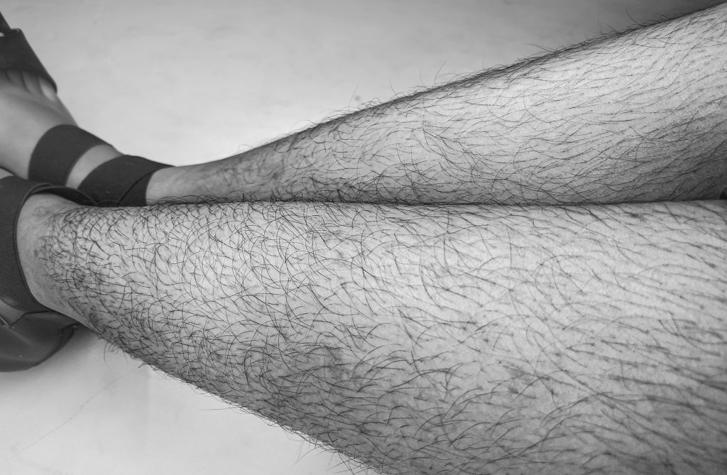 Why do women have hairy legs